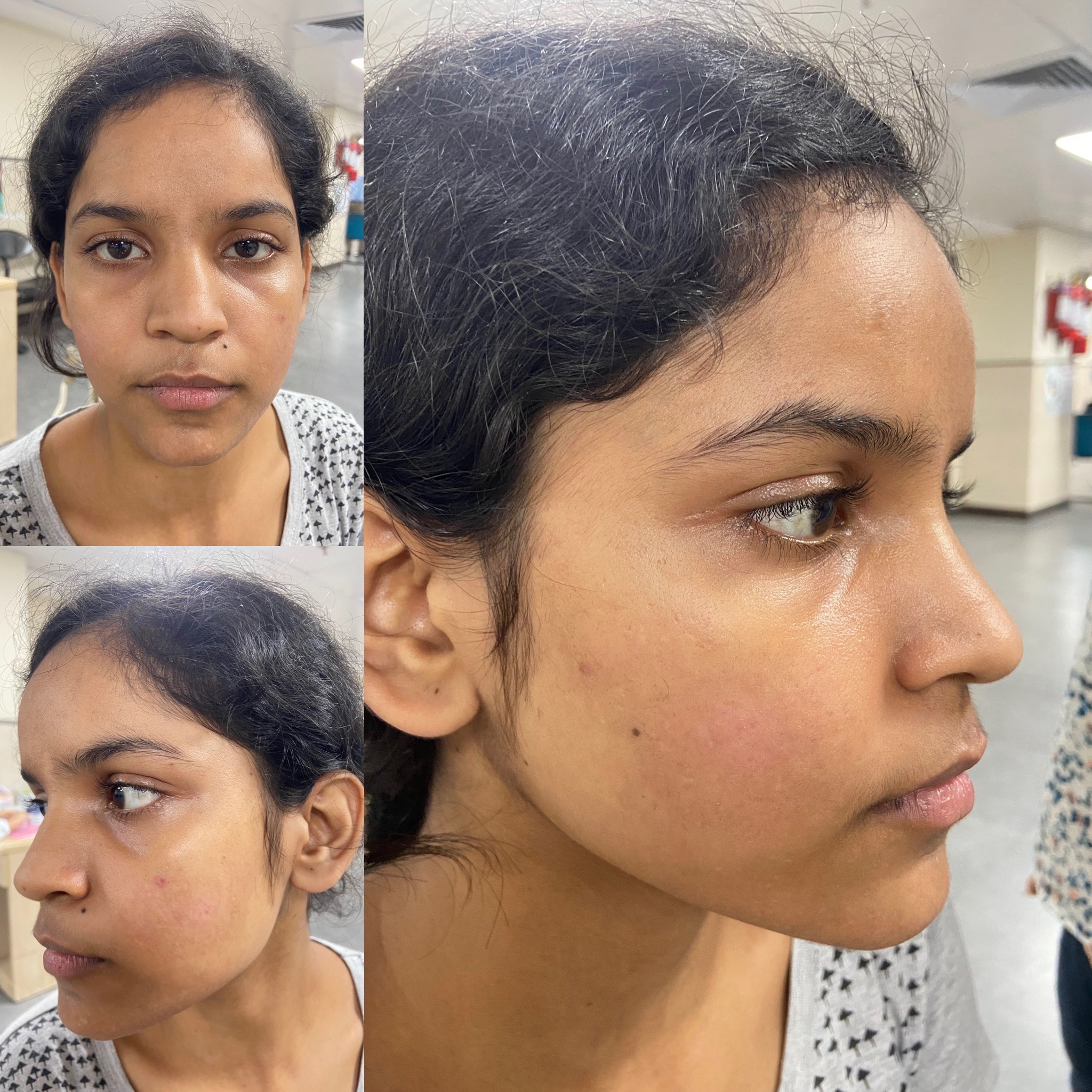 Clear Skin | Iksana Wellness