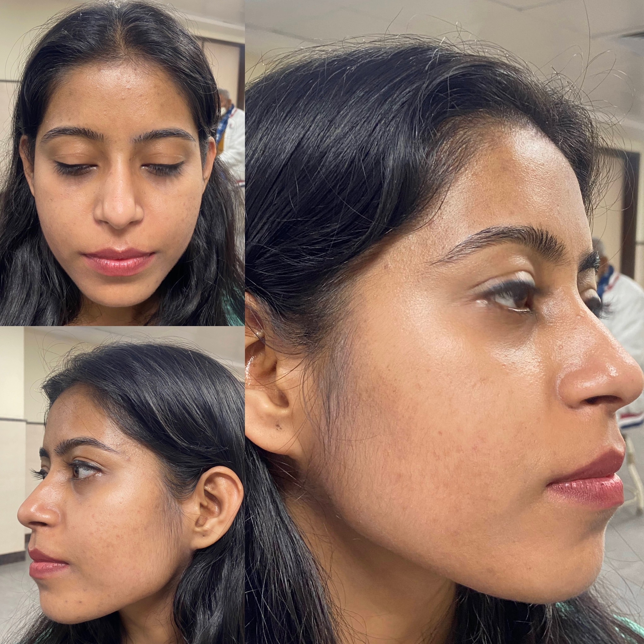 SkinCare | Iksana Wellness