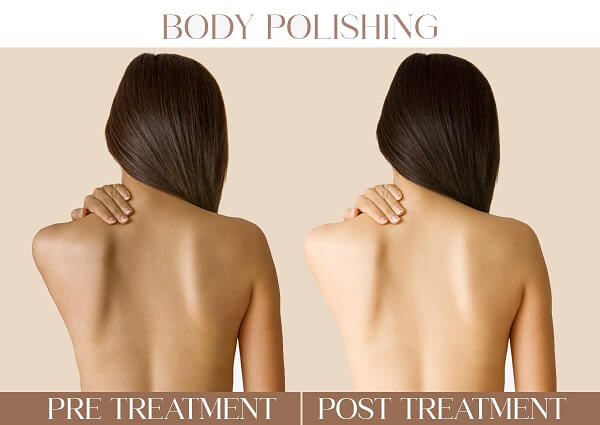 Body Polishing | Iksana Wellness