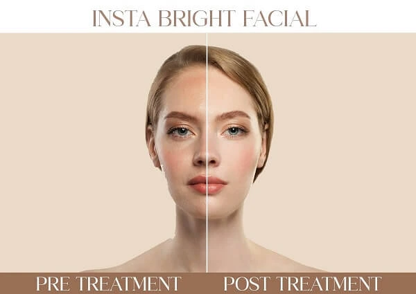 Insta Bright Facial | Iksana Wellness