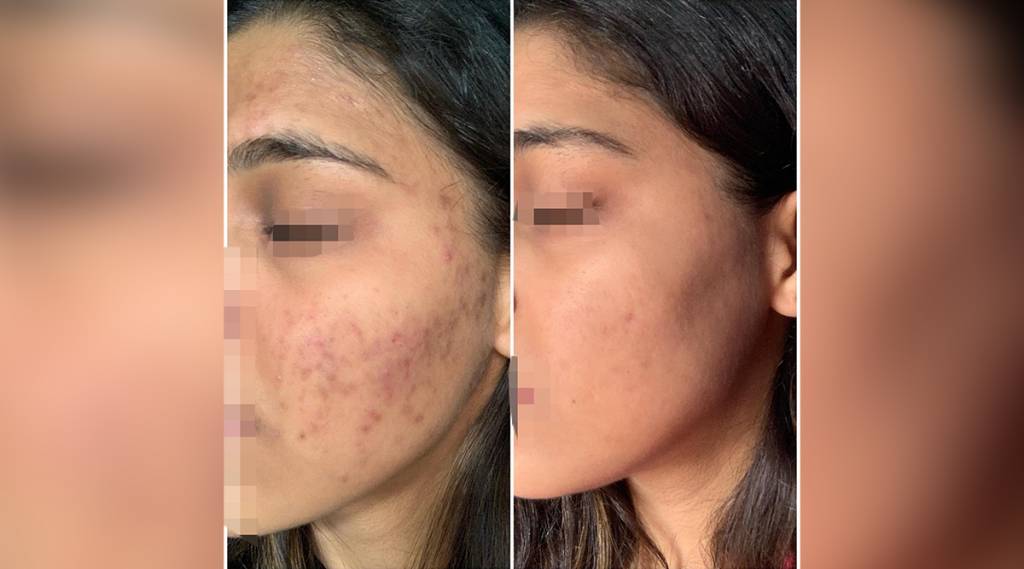 Best Dermatologist in Delhi