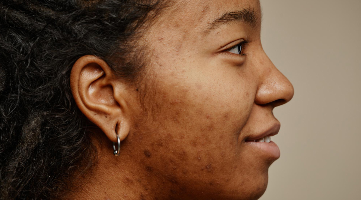 Understanding Skin Discoloration: Causes and Care - Best Dermatologist ...