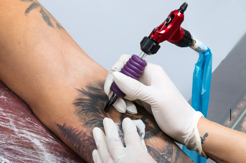 Tattoo removal in Delhi