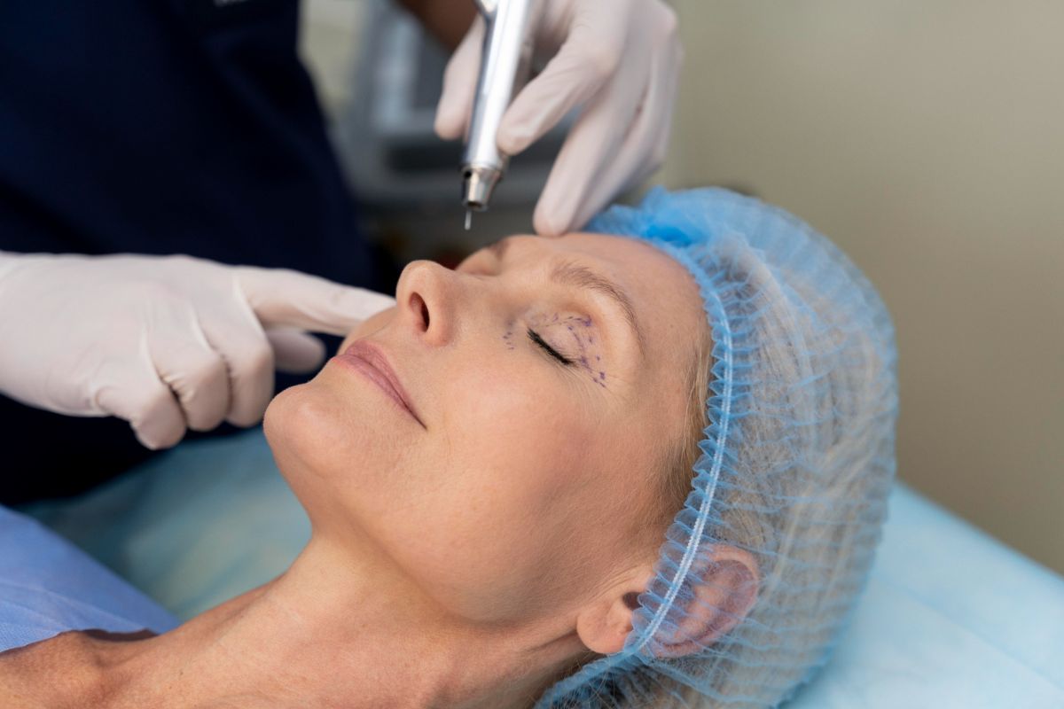 Morpheus8 Treatment in Delhi