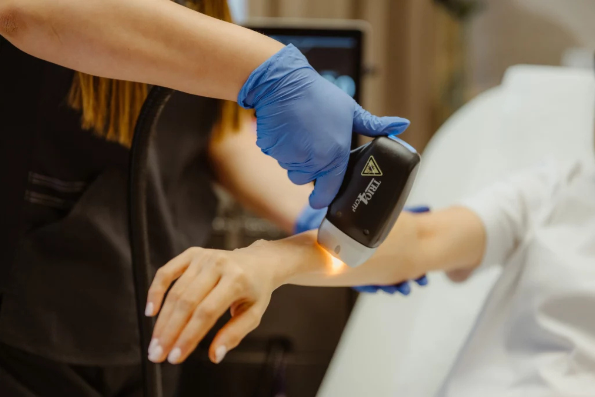 Arms Laser Hair Removal