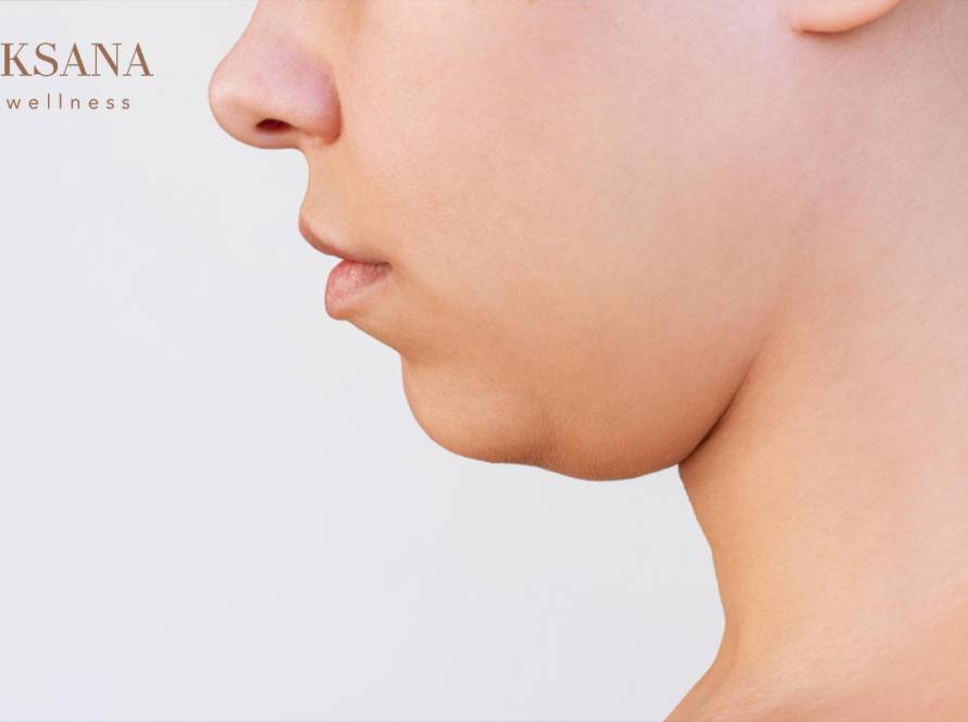 Double Chin Reduction