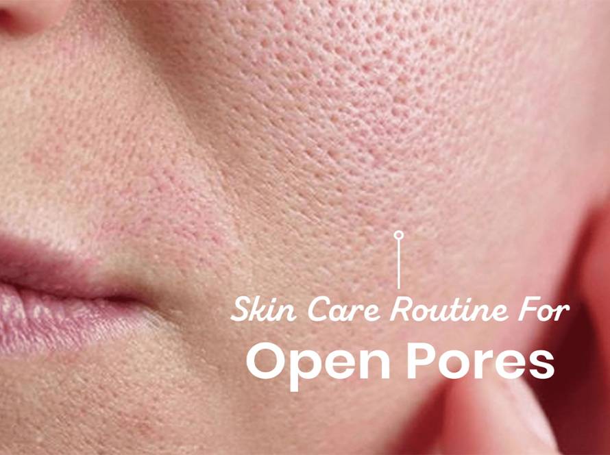 Open Pore Treatment in Delhi