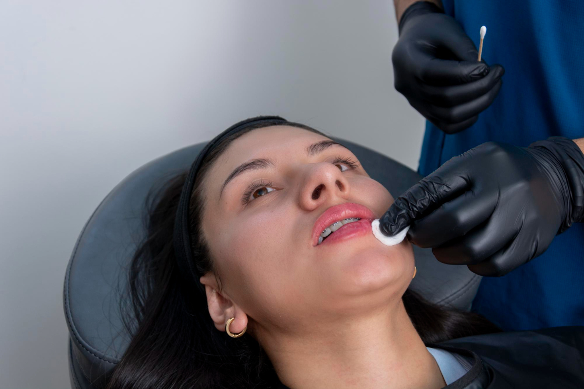 Dark Lips Lightening