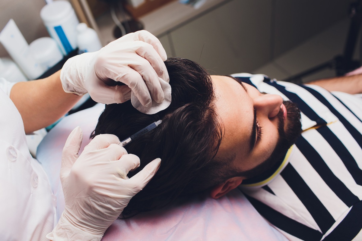 Advanced Hair Loss Treatment for Men in Delhi