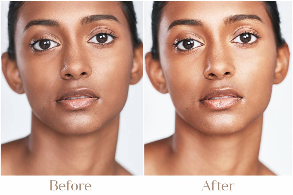 Advanced Skin Dullness and Tan Removal Treatment in Delhi