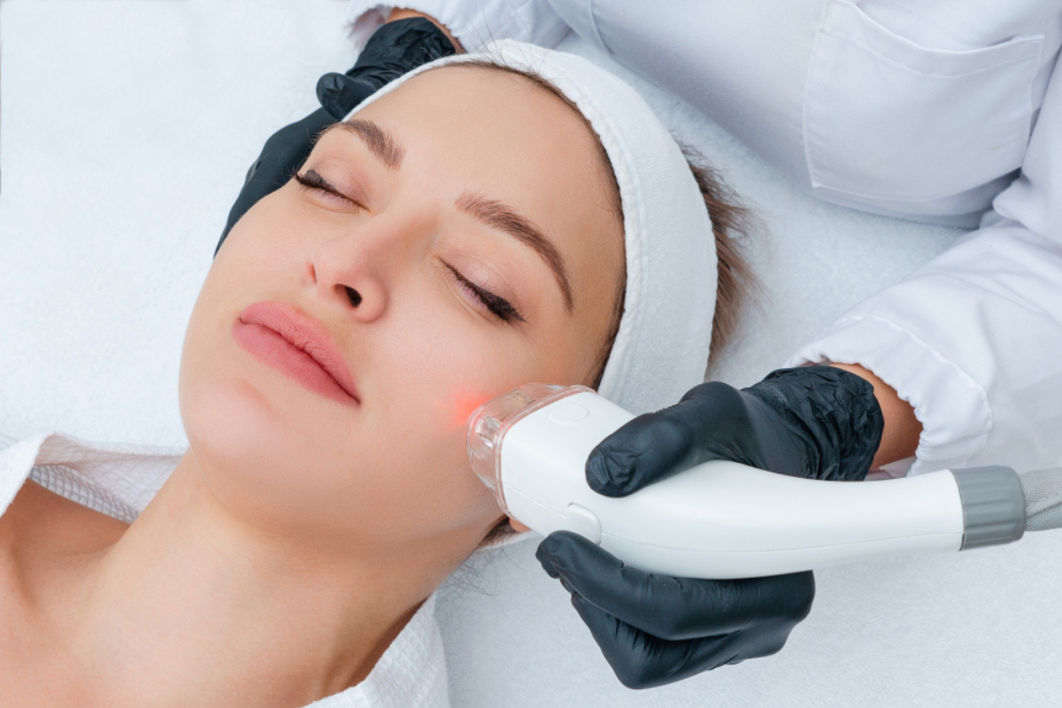Advanced Laser Facial Hair Removal in Delhi