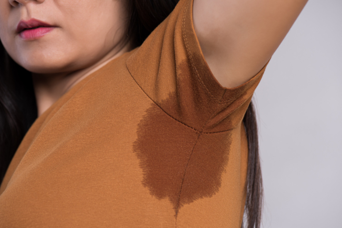 Hyperhidrosis Treatment in Delhi